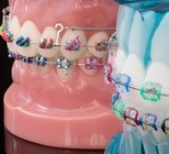 ניתוח אורתוגנטי - תמונת המחשה